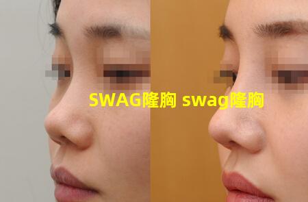 SWAG隆胸 swag隆胸